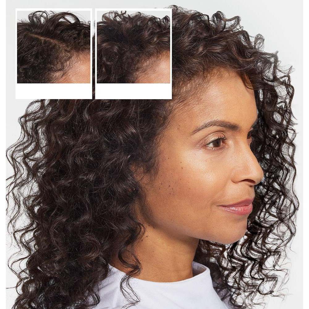 Champú Anticaída - Champú Para La Caída Del Cabello 240 Ml